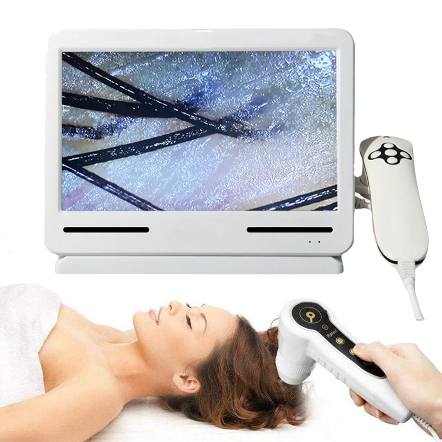 Appareil de Diagnostic Capillaire